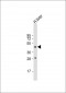MMAA Antibody (N-term)